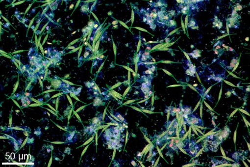 Mikroskopische Aufnahme einer Plastikoberfläche, die mit Biofilm bedeckt ist. Auf schwarzem Hintergrund sind viele grünliche, fadenförmige Algenstrukturen zu sehen, dazwischen blau-violette und rosafarbene Punkte, die Bakterien und andere Mikroorganismen darstellen. Die Aufnahme zeigt, wie sich winzige Lebewesen auf Plastik ansiedeln und einen Belag bilden, der typische Geruchsstoffe wie Dimethylsulfid freisetzt.